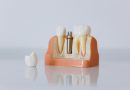 How Implant-Supported Dentures Improve Comfort, Health, and Confidence